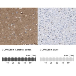 Coronin-2B Antibody, Novus Biologicals:Antibodies:Primary Antibodies